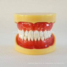 China Medizinisches anatomisches vorbildliches hartes zahnmedizinisches Kiefer-Modell 13013 Zahnfleisch-Zahn-28